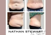 Dr Nathan Stewart