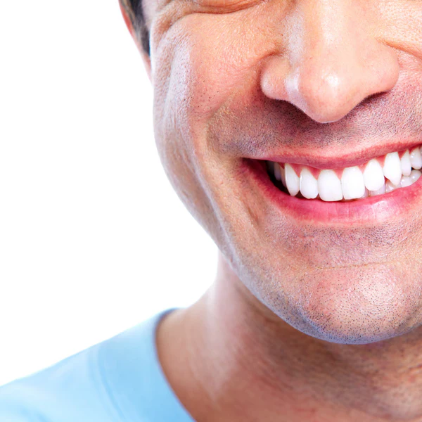 LED Teeth Whitening | Miami Kiss International